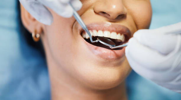 Best Broken or Cracked Tooth Emergency Dentist in Logan, UT